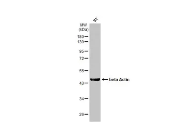 Anti-beta Actin antibody used in Western Blot (WB). GTX124214