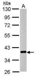Anti-CTGF antibody used in Western Blot (WB). GTX124233