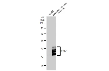 Anti-CTGF antibody used in Western Blot (WB). GTX124233