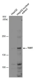 Anti-TERT antibody [C2C3-2], C-term used in Western Blot (WB). GTX124242