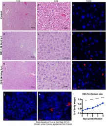 Anti-Dengue virus NS3 protein antibody used in IHC (Paraffin sections) (IHC-P). GTX124252