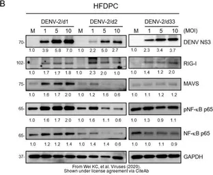 Anti-Dengue virus NS3 protein antibody used in Western Blot (WB). GTX124252