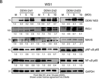 Anti-Dengue virus NS3 protein antibody used in Western Blot (WB). GTX124252