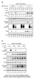 Anti-Dengue virus NS3 protein antibody used in Western Blot (WB). GTX124252