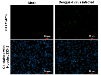 Anti-Dengue virus NS3 protein antibody used in Immunocytochemistry/ Immunofluorescence (ICC/IF). GTX124252