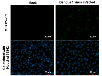 Anti-Dengue virus NS3 protein antibody used in Immunocytochemistry/ Immunofluorescence (ICC/IF). GTX124252
