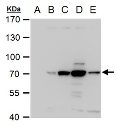 Anti-Dengue virus NS3 protein antibody used in Western Blot (WB). GTX124252