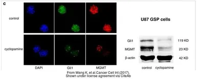 Anti-Gli1 antibody used in Western Blot (WB). GTX124274