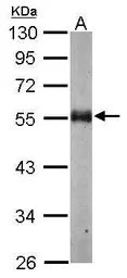 Anti-alpha Tubulin antibody used in Western Blot (WB). GTX124303