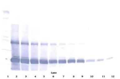 Anti-EMAP II antibody used in Western Blot (WB). GTX12442