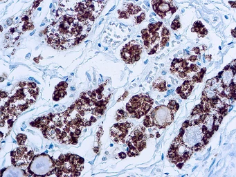 Anti-TPO antibody [MoAb47] used in IHC (Paraffin sections) (IHC-P). GTX12500