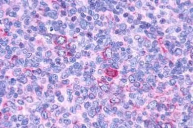 Anti-GPR132 antibody used in IHC (Paraffin sections) (IHC-P). GTX12530