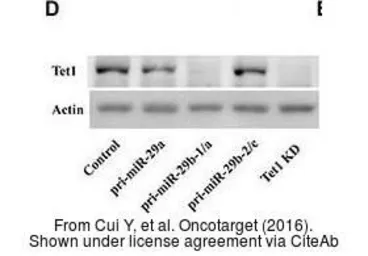 Anti-TET1 antibody [N1], N-term used in Western Blot (WB). GTX125888