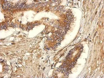 Anti-GEF-H1 antibody used in IHC (Paraffin sections) (IHC-P). GTX125893