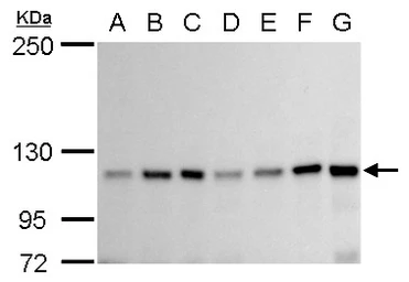 Anti-GEF-H1 antibody used in Western Blot (WB). GTX125893