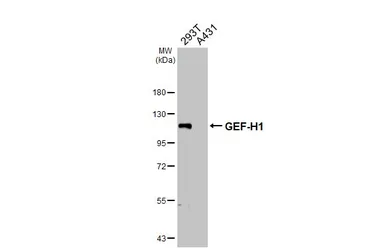 Anti-GEF-H1 antibody used in Western Blot (WB). GTX125893