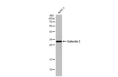 Anti-Galectin 3 antibody used in Western Blot (WB). GTX125897