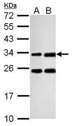 Anti-Galectin 3 antibody used in Western Blot (WB). GTX125897