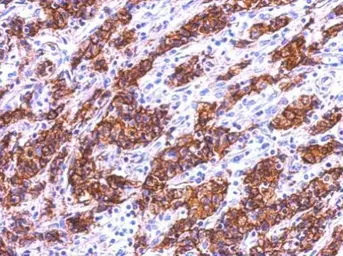 Anti-Galectin 4 antibody used in IHC (Paraffin sections) (IHC-P). GTX125898