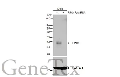 Anti-EPCR antibody used in Western Blot (WB). GTX125912