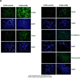 Anti-SNAI1 antibody used in Western Blot (WB). GTX125918