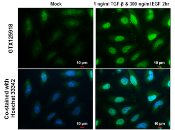 Anti-SNAI1 antibody used in Immunocytochemistry/ Immunofluorescence (ICC/IF). GTX125918