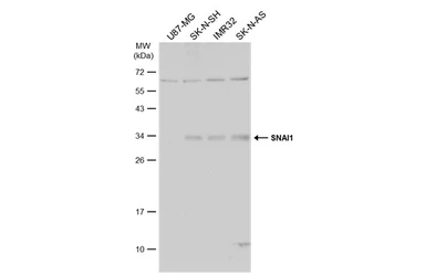 Anti-SNAI1 antibody used in Western Blot (WB). GTX125918