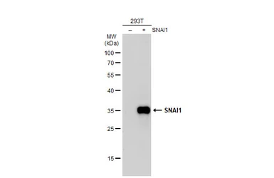 Anti-SNAI1 antibody used in Western Blot (WB). GTX125918