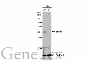 Anti-SNAI1 antibody used in Western Blot (WB). GTX125918