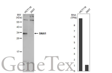 Anti-SNAI1 antibody used in Western Blot (WB). GTX125918