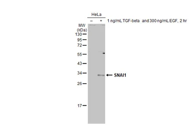Anti-SNAI1 antibody used in Western Blot (WB). GTX125918
