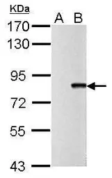 Anti-Influenza A virus PB2 protein antibody used in Western Blot (WB). GTX125925