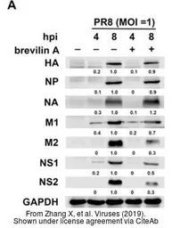 Anti-Influenza A virus M1 (matrix protein) antibody used in Western Blot (WB). GTX125928