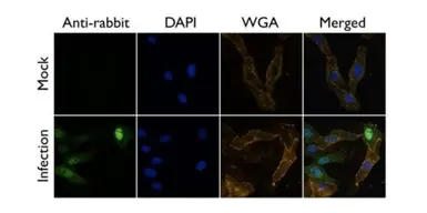 Anti-Influenza A virus PA protein antibody used in Immunocytochemistry/ Immunofluorescence (ICC/IF). GTX125932