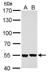 Anti-SHMT2 antibody used in Western Blot (WB). GTX125939