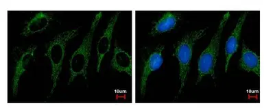 Anti-SHMT2 antibody used in Immunocytochemistry/ Immunofluorescence (ICC/IF). GTX125939