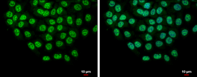 Anti-SLU7 antibody used in Immunocytochemistry/ Immunofluorescence (ICC/IF). GTX125955
