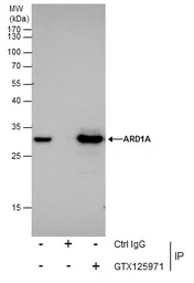 Anti-ARD1A antibody used in Immunoprecipitation (IP). GTX125971
