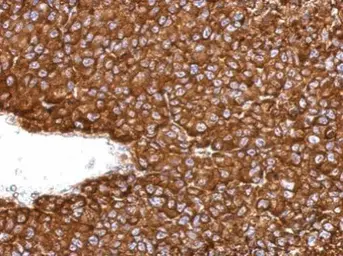 Anti-ARD1A antibody used in IHC (Paraffin sections) (IHC-P). GTX125971