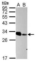Anti-ARD1A antibody used in Western Blot (WB). GTX125971