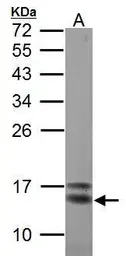 Anti-Crabp2a antibody used in Western Blot (WB). GTX125986