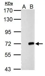 Anti-Cre recombinase antibody used in Western Blot (WB). GTX127271