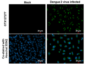 Anti-Dengue virus Envelope protein antibody used in Immunocytochemistry/ Immunofluorescence (ICC/IF). GTX127277