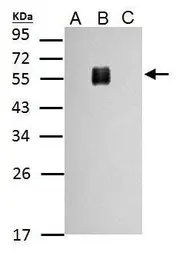Anti-Dengue virus Envelope protein antibody used in Western Blot (WB). GTX127277