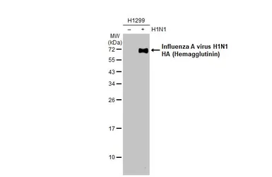 Anti-Influenza A virus H1N1 HA (Hemagglutinin) antibody used in Western Blot (WB). GTX127295