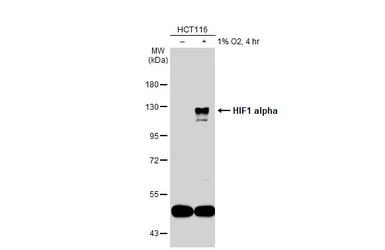 Anti-HIF1 alpha antibody used in Western Blot (WB). GTX127309