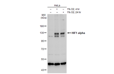 Anti-HIF1 alpha antibody used in Western Blot (WB). GTX127309