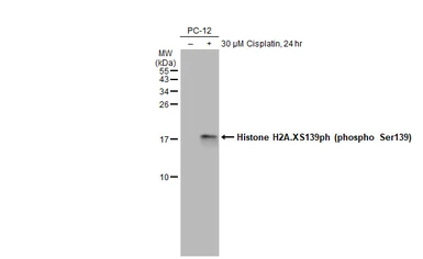 Anti-Histone H2A.XS139ph (phospho Ser139) antibody used in Western Blot (WB). GTX127340