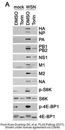 Anti-Influenza A virus H1N1 HA (Hemagglutinin) antibody used in Western Blot (WB). GTX127357