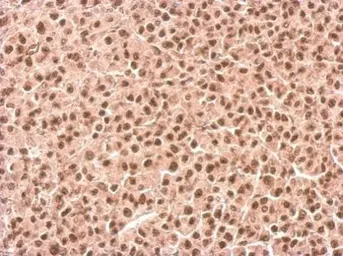 Anti-HYPB/SETD2 antibody used in IHC (Paraffin sections) (IHC-P). GTX127905